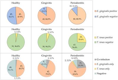 Oral Colonization by Entamoeba gingivalis and Trichomonas tenax: A PCR-Based Study in Health, <mark class="highlighted">Gingivitis</mark>, and Periodontitis